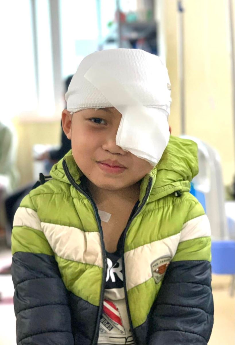 Cậu bé 8 tuổi người dân tộc Dao với u máu khủng ở mắt được điều trị ổn định